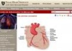 Las arterias coronarias | Recurso educativo 18211