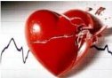 Arritmias cardíacas | Recurso educativo 73181