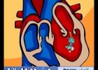 Sistema Circulatorio | Recurso educativo 115461