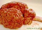 adn-dna: 359- Biologia humana: dissecció de cervell | Recurso educativo 117869