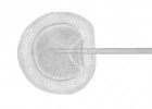 IVI- Reproduccion asistida, fertilidad, inseminacion, fecundacion invitro | Recurso educativo 731535